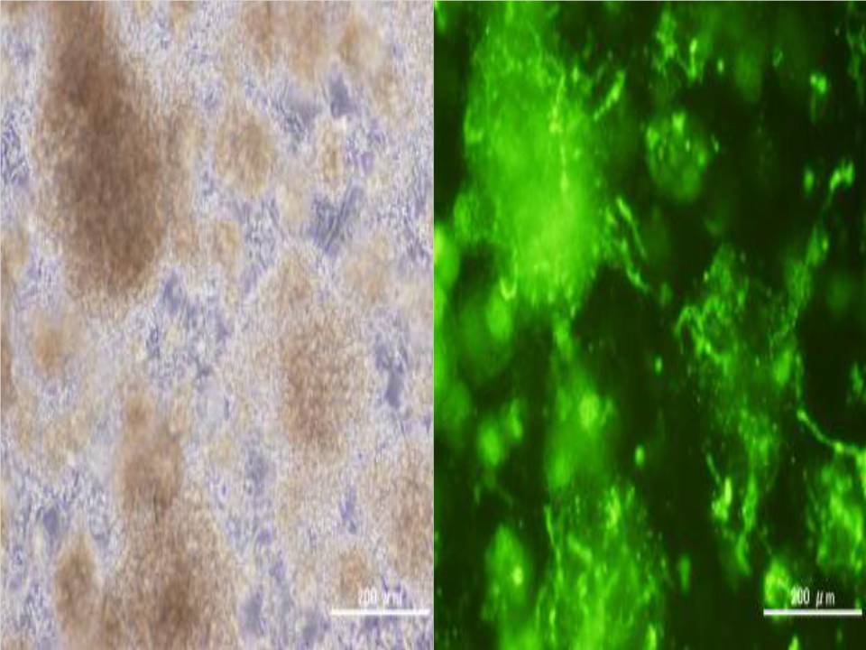 Neurosphres - Neural Stem cells Derived from Mouse SVZ - 72 hours after electroporation